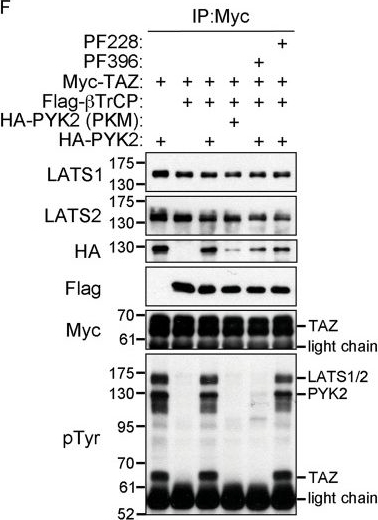 Fig.6.F showing Western Blotting in a Homo sapiens (Human) sample from the publication: PYK2 negatively regulates the Hippo pathway in TNBC by stabilizing TAZ protein.