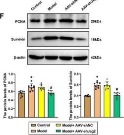 Fig.6.F showing Western Blotting from the publication: Unveiling the role of Jagged2 in hypoxic pulmonary arterial hypertension: A NOX2-mediated pathway.