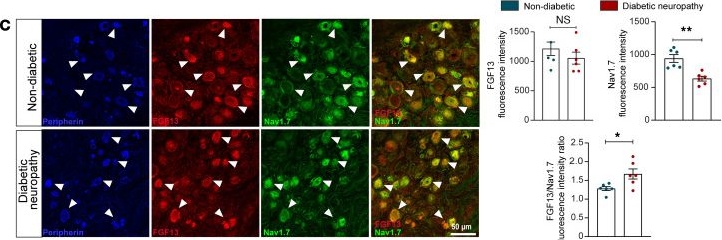 Fig.8.C showing Immunohistochemistry-immunofluorescence in a Homo sapiens (Human) sample from the publication: Sensory neuron-expressed FGF13 controls nociceptive signaling in diabetic neuropathy models.