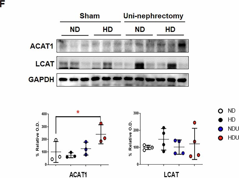 Fig.3.F showing Western Blotting from the publication: High-fat diet promotes lipotoxicity in the podocytes of uninephrectomized mice: a targeted lipidomics and kidney podocyte-specific analysis.