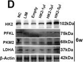 Fig.5.D showing Western Blotting from the publication: Quercetin improves retinal glycolysis to slow myopia progression through orchestrating the AKT/FOXO/HK2 axis.