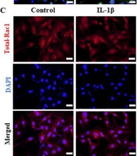 Fig.3.C showing Immunocytochemistry-immunofluorescence from the publication: Regulation of H-type angiogenesis and permeability in the subchondral bone of osteoarthritis: the role of Slit3 and the Robo4/Rac1-GTP/ROS axis.