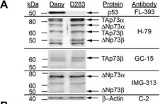 Fig.2.A showing Western Blotting from the publication: Overexpressed TP73 induces apoptosis in medulloblastoma.