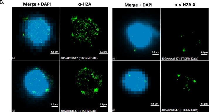 Fig.4.B showing Immunocytochemistry-immunofluorescence from the publication: Phosphorylation of the Canonical Histone H2A Marks Foci of Damaged DNA in Malaria Parasites.