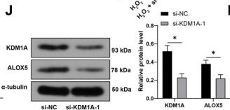Fig.3.J showing Western Blotting from the publication: LncRNA PVT1 Facilitates Phenotypic Switching of Vascular Smooth Muscle Cells in Intracranial Aneurysms by Recruiting KDM1A to Reduce H3K9me2 Modification.