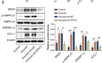 Fig.4.E showing Western Blotting from the publication: BRD4 Inhibitor Alleviates Recurrent Spontaneous Abortion via Regulating BRD4/STAT3/IL-17A Axis to Decrease the Th17 Cell Differentiation.
