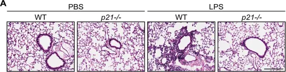 Fig.2.A showing Immunohistochemistry in a Mus musculus (House mouse) sample from the publication: p21 facilitates chronic lung inflammation via epithelial and endothelial cells.