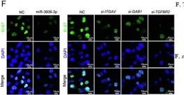Fig.7.F showing Immunocytochemistry-immunofluorescence from the publication: miR-3606-3p alleviates skin fibrosis by integratively suppressing the integrin/FAK, p-AKT/p-ERK, and TGF-β signaling cascades.