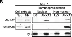 Fig.4.B showing Western Blotting in a Homo sapiens (Human) sample from the publication: Genotoxic agents promote the nuclear accumulation of annexin A2: role of annexin A2 in mitigating DNA damage.