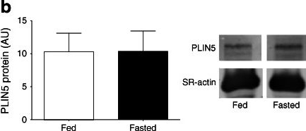 Decoration of intramyocellular lipid droplets with PLIN5 modulates fasting-induced insulin resistance and lipotoxicity in humans.