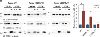 Fig.5.B showing Western Blotting in a Homo sapiens (Human) sample from the publication: Parkin truncating variants result in a loss-of-function phenotype.