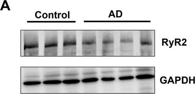 Fig.3.A showing Western Blotting from the publication: Clustering Properties of Neuronal Ryanodine Receptor 2 and Remodeling in the APP/PS1 Mouse Model of Alzheimer's Disease.