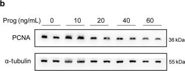 Fig.4.B showing Western Blotting from the publication: Gestational progesterone restores menstrual cycle in PCOS patients via enhancing ovary estrogen production.