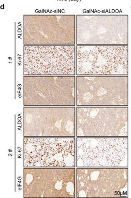 Fig.8.D showing Immunohistochemistry from the publication: Aldolase A Accelerates Cancer Progression by Modulating mRNA Translation and Protein Biosynthesis via Noncanonical Mechanisms.