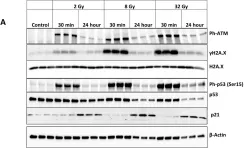 Fig.3.A showing Western Blotting from the publication: Irradiation-Induced Upregulation of miR-711 Inhibits DNA Repair and Promotes Neurodegeneration Pathways.
