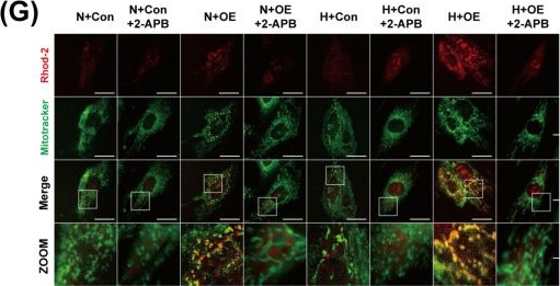 Fig.11.G showing Immunocytochemistry-immunofluorescence from the publication: Fasting Enhances Cardiomyocyte Hypoxia Tolerance by Regulating Ca2+ Transport at Mitochondria-Endoplasmic Reticulum Contact Sites.