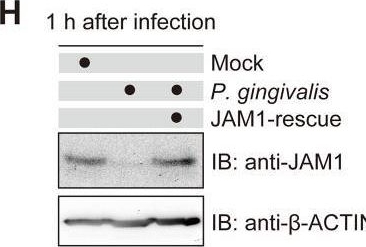 Fig.8.H showing Western Blotting in a Porphyromonas gingivalis sample from the publication: Porphyromonas gingivalis induces penetration of lipopolysaccharide and peptidoglycan through the gingival epithelium via degradation of junctional adhesion molecule 1.