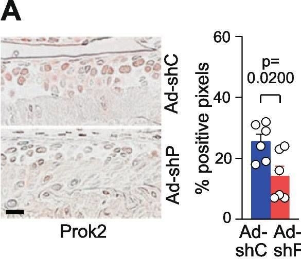 Fig.6.A showing Immunohistochemistry in a Homo sapiens (Human) sample from the publication: Prokineticin 2 is a catabolic regulator of osteoarthritic cartilage destruction in mouse.