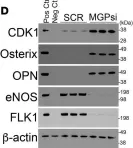 Fig.3.D showing Western Blotting in a Mus musculus (House mouse) sample from the publication: CDK1 inhibition reduces osteogenesis in endothelial cells in vascular calcification.