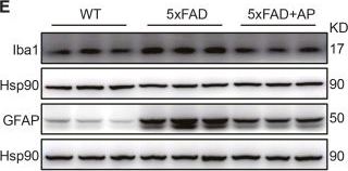 Fig.3.E showing Western Blotting from the publication: Andrographolide attenuates microglial senescence in Alzheimer's disease mice by suppressing the STAT3 signaling.