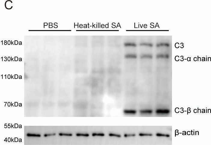 Fig.1.C showing Western Blotting from the publication: Dual RNA-seq reveals the complement protein C3-mediated host-pathogen interaction in the brain abscess caused by Staphylococcus aureus.