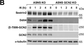 Fig.12.B showing Western Blotting from the publication: mTORC1 senses glutamine and other&nbsp;amino acids through GCN2.
