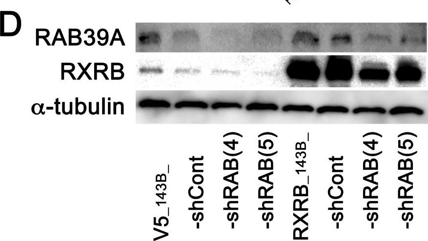 Fig.4.D showing Western Blotting in a Homo sapiens (Human) sample from the publication: Prominent role of RAB39A-RXRB axis in cancer development and stemness.