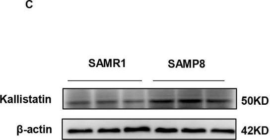Fig.1.C showing Western Blotting in a Homo sapiens (Human) sample from the publication: The novel role of Kallistatin in linking metabolic syndromes and cognitive memory deterioration by inducing amyloid-β plaques accumulation and tau protein hyperphosphorylation.