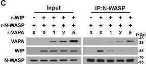 Fig.6.C showing Western Blotting from the publication: Large Oncosome-Loaded VAPA Promotes Bone-Tropic Metastasis of Hepatocellular Carcinoma Via Formation of Osteoclastic Pre-Metastatic Niche.
