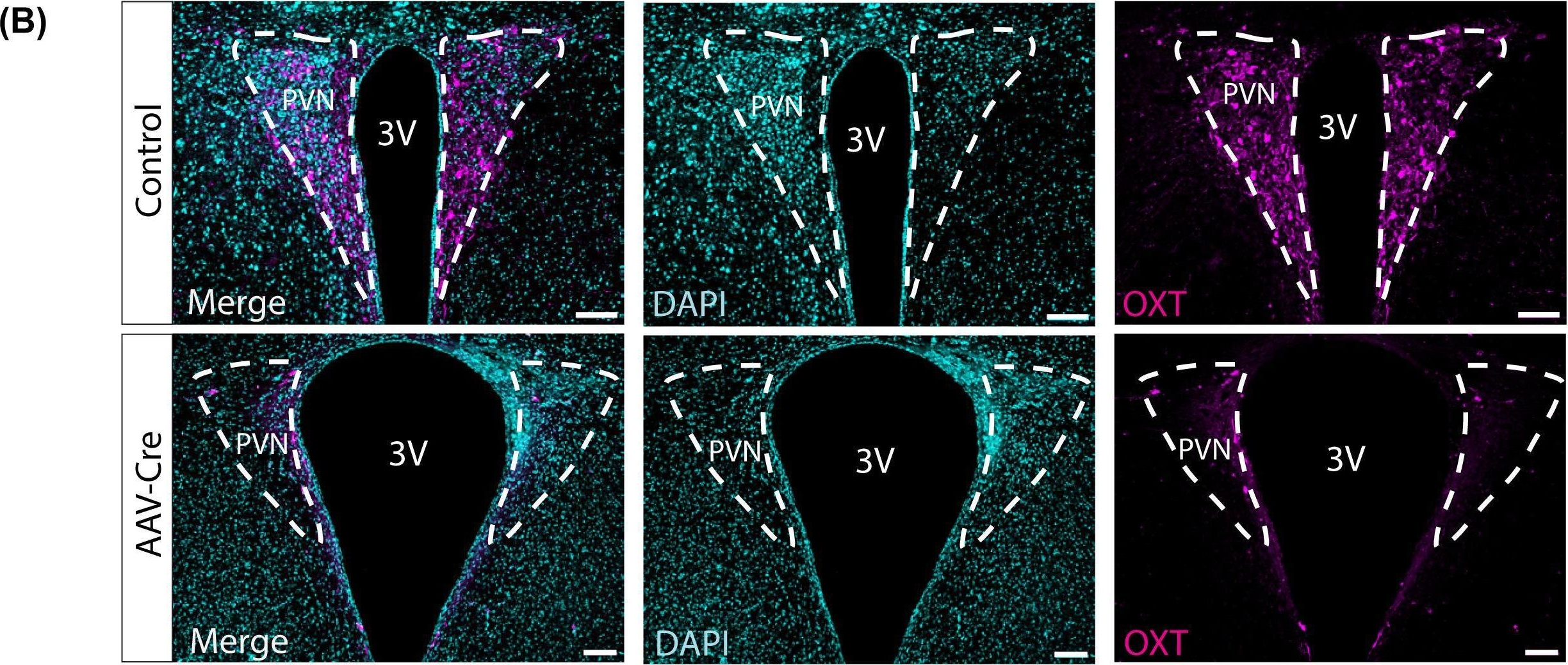 Fig.2.B showing Immunohistochemistry-immunofluorescence in a Mus musculus (House mouse) sample from the publication: Metabolic and behavioral alterations associated with viral vector-mediated toxicity in the paraventricular hypothalamic nucleus.