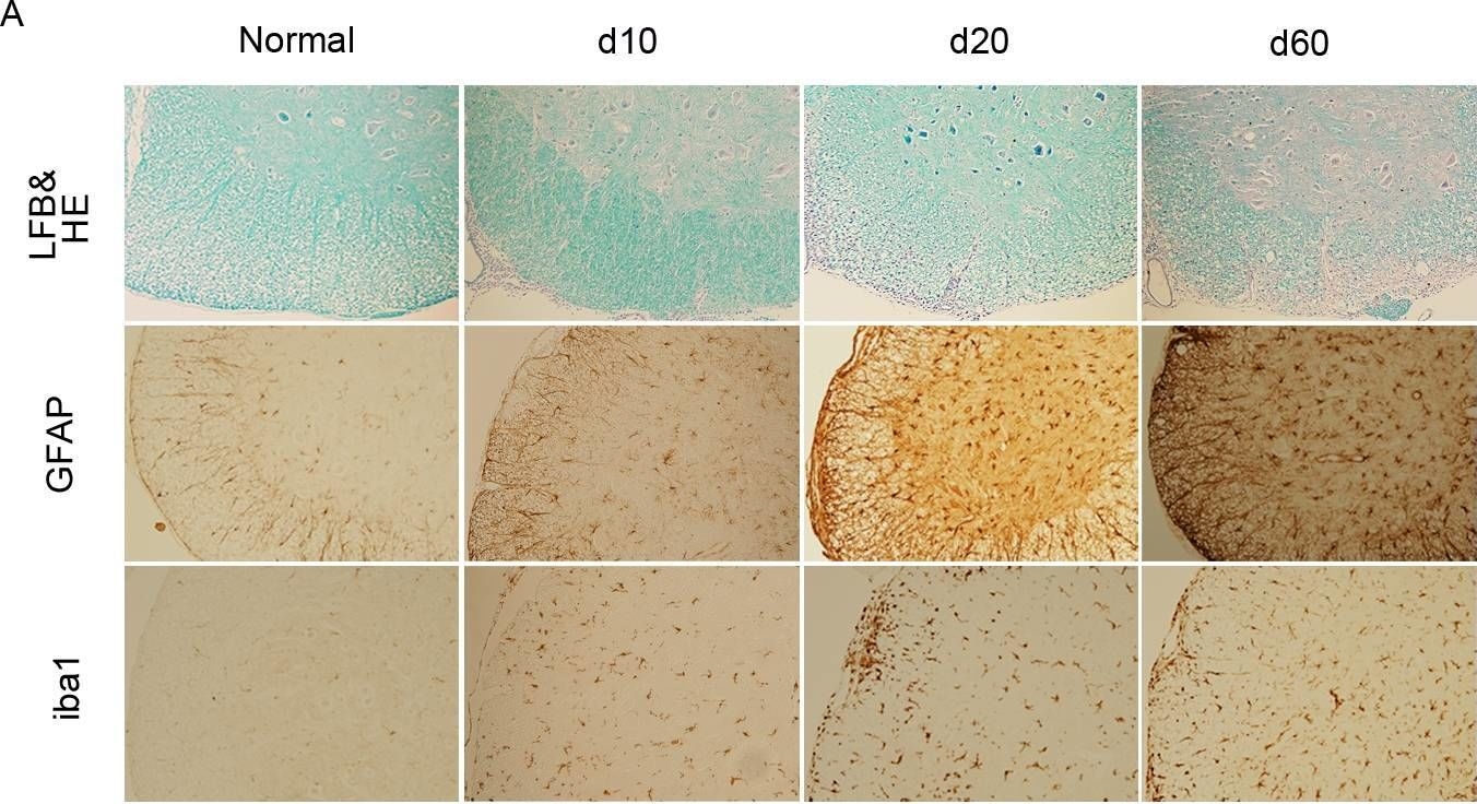 Delayed onset of experimental autoimmune encephalomyelitis in Olig1 deficient mice.