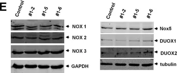 Fig.1.E showing Western Blotting in a Homo sapiens (Human) sample from the publication: CRISPR-Cas9 Mediated NOX4 Knockout Inhibits Cell Proliferation and Invasion in HeLa Cells.