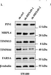 Fig.7.L showing Western Blotting in a Homo sapiens (Human) sample from the publication: DDX49 as a novel prognostic biomarker regulates colorectal cancer cell proliferation through the TIMM44-PI3K-AKT pathway.