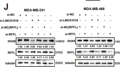 Fig.5.J showing Western Blotting from the publication: ETS-1-activated LINC01016 over-expression promotes tumor progression via suppression of RFFL-mediated DHX9 ubiquitination degradation in breast cancers.