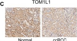 Fig.12.C showing Immunohistochemistry in a Homo sapiens (Human) sample from the publication: Identification and Validation of the Prognostic Panel in Clear Cell Renal Cell Carcinoma Based on Resting Mast Cells for Prediction of Distant Metastasis and Immunotherapy Response.
