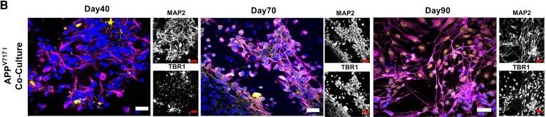Fig.4.B showing Immunohistochemistry-immunofluorescence in a Homo sapiens (Human) sample from the publication: Methodology for human-induced pluripotent stem cell-derived excitatory and inhibitory neuron coculture with astrocytes for Alzheimer's disease modelling.