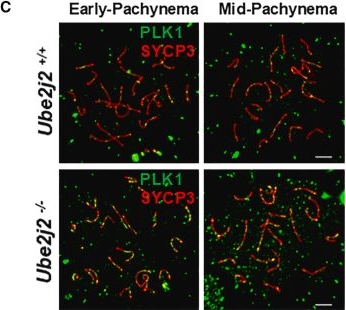 Fig.5.C showing Immunohistochemistry-immunofluorescence in a Mus musculus (House mouse) sample from the publication: UBE2J2 is essential for the progression of meiosis prophase I during spermatogenesis in mice.
