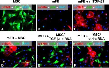 MSCs rescue impaired wound healing in a murine LAD1 model by adaptive responses to low TGF-β1 levels.
