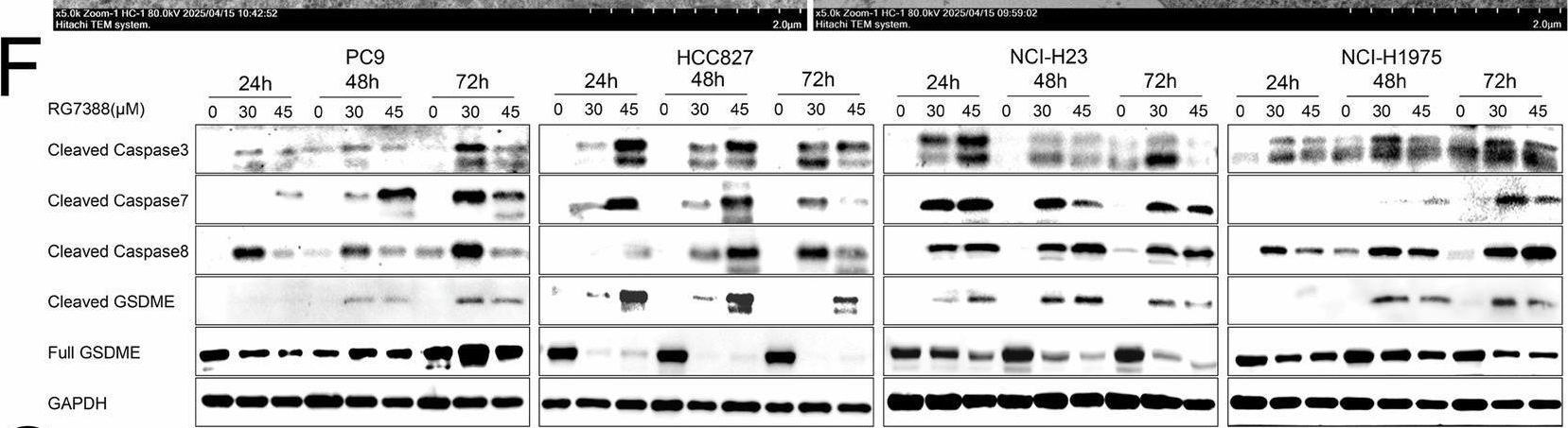 Fig.2.F showing Western Blotting from the publication: Repurposing MDM2 inhibitor RG7388 for TP53-mutant NSCLC: a p53-independent pyroptotic mechanism via ROS/p-p38/NOXA/caspase-3/GSDME axis.