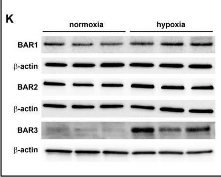 Fig.2.K showing Western Blotting in a Homo sapiens (Human) sample from the publication: Hypoxia-Dependent Upregulation of VEGF Relies on β3-Adrenoceptor Signaling in Human Retinal Endothelial and Müller Cells.