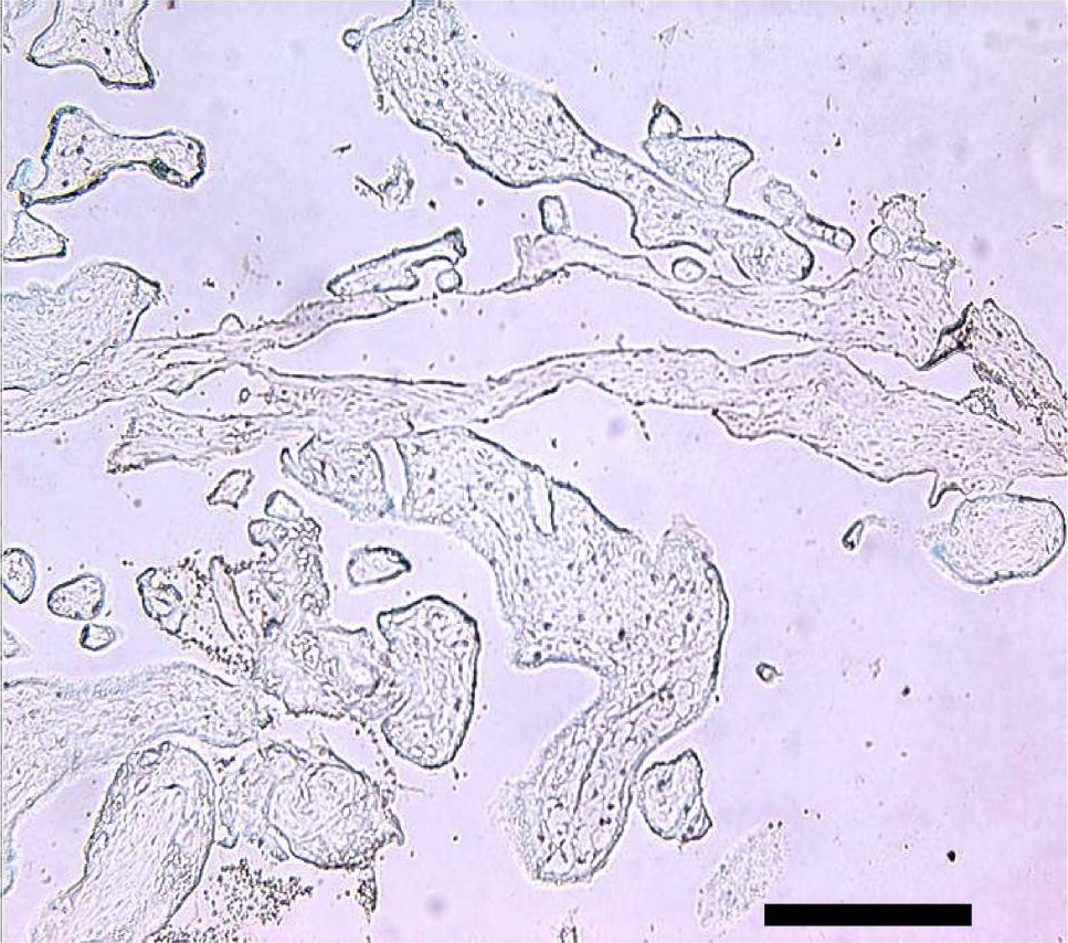 Fig.1.B showing Immunohistochemistry in a Homo sapiens (Human) sample from the publication: Maternal celiac disease autoantibodies bind directly to syncytiotrophoblast and inhibit placental tissue transglutaminase activity.