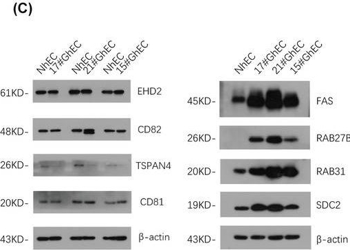 Fig.2.C showing Western Blotting from the publication: RAB31 in glioma-derived endothelial cells promotes glioma cell invasion via extracellular vesicle-mediated enrichment of MYO1C.