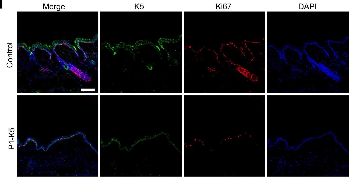 PINCH-1 promotes IGF-1 receptor expression and skin cancer progression through inhibition of the GRB10-NEDD4 complex.