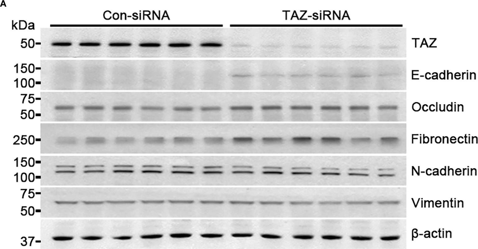 Fig.2.A showing Western Blotting in a Homo sapiens (Human) sample from the publication: TAZ is involved in breast cancer cell migration via regulating actin dynamics.