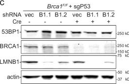 Fig.2.C showing Western Blotting from the publication: Nuclear deformability increases PARPi sensitivity in BRCA1-deficient cells by increasing microtubule-dependent DNA break mobility.