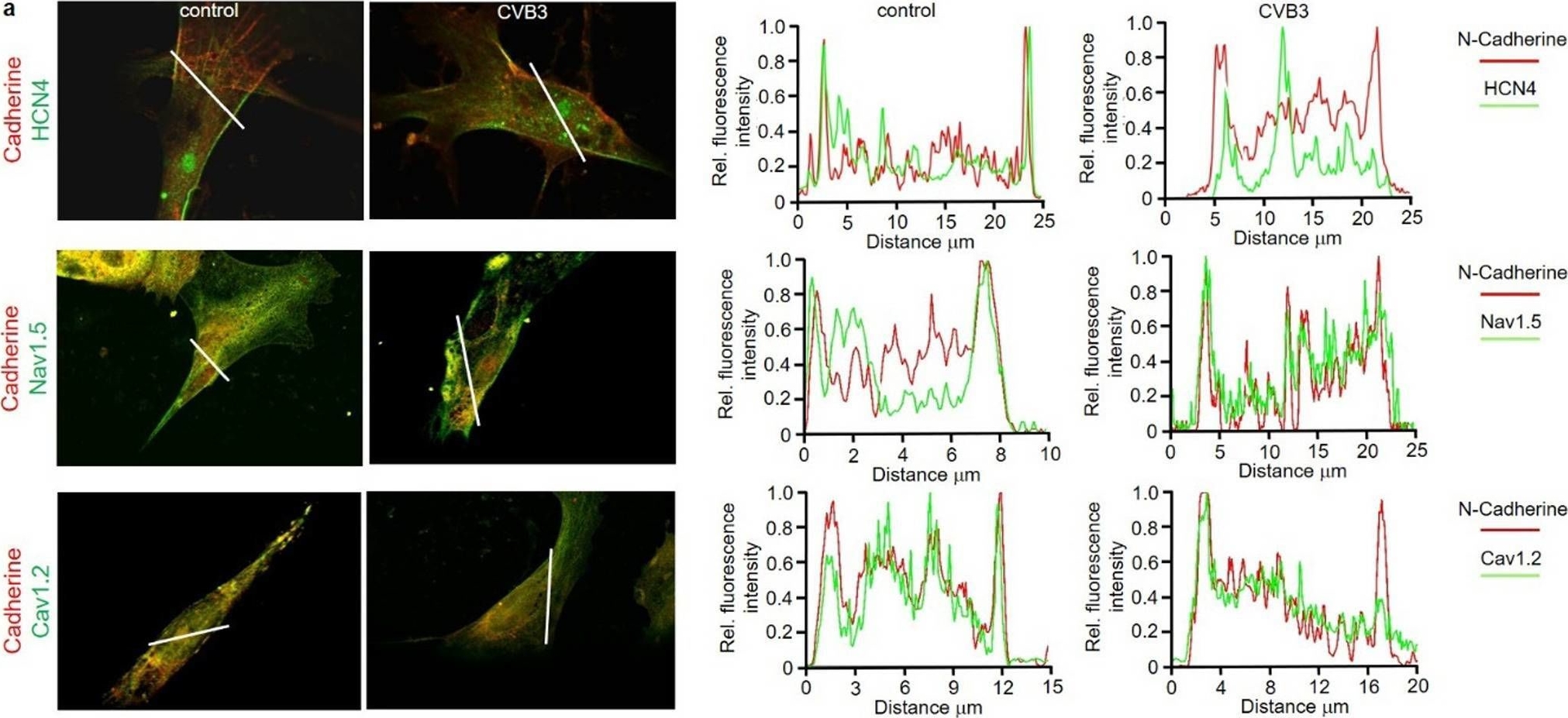 Fig.2.A showing Immunocytochemistry-immunofluorescence from the publication: Virus-induced inhibition of cardiac pacemaker channel HCN4 triggers bradycardia in human-induced stem cell system.