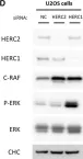 Fig.2.D showing Western Blotting from the publication: HERC2 deficiency activates C-RAF/MKK3/p38 signalling pathway altering the cellular response to oxidative stress.