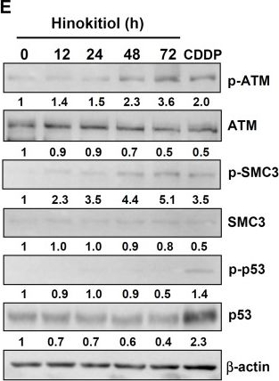 Fig.3.E showing Western Blotting in a Homo sapiens (Human) sample from the publication: Hinokitiol induces DNA damage and autophagy followed by cell cycle arrest and senescence in gefitinib-resistant lung adenocarcinoma cells.