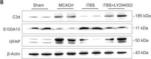 Fig.7.B showing Western Blotting from the publication: Intermittent theta-burst stimulation promotes neurovascular unit remodeling after ischemic stroke in a mouse model.