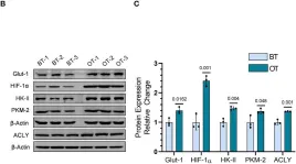 Fig.5.B showing Western Blotting from the publication: Mitochondrial uncoupler DNP induces coexistence of dual-state hyper-energy metabolism leading to tumor growth advantage in human glioma xenografts.